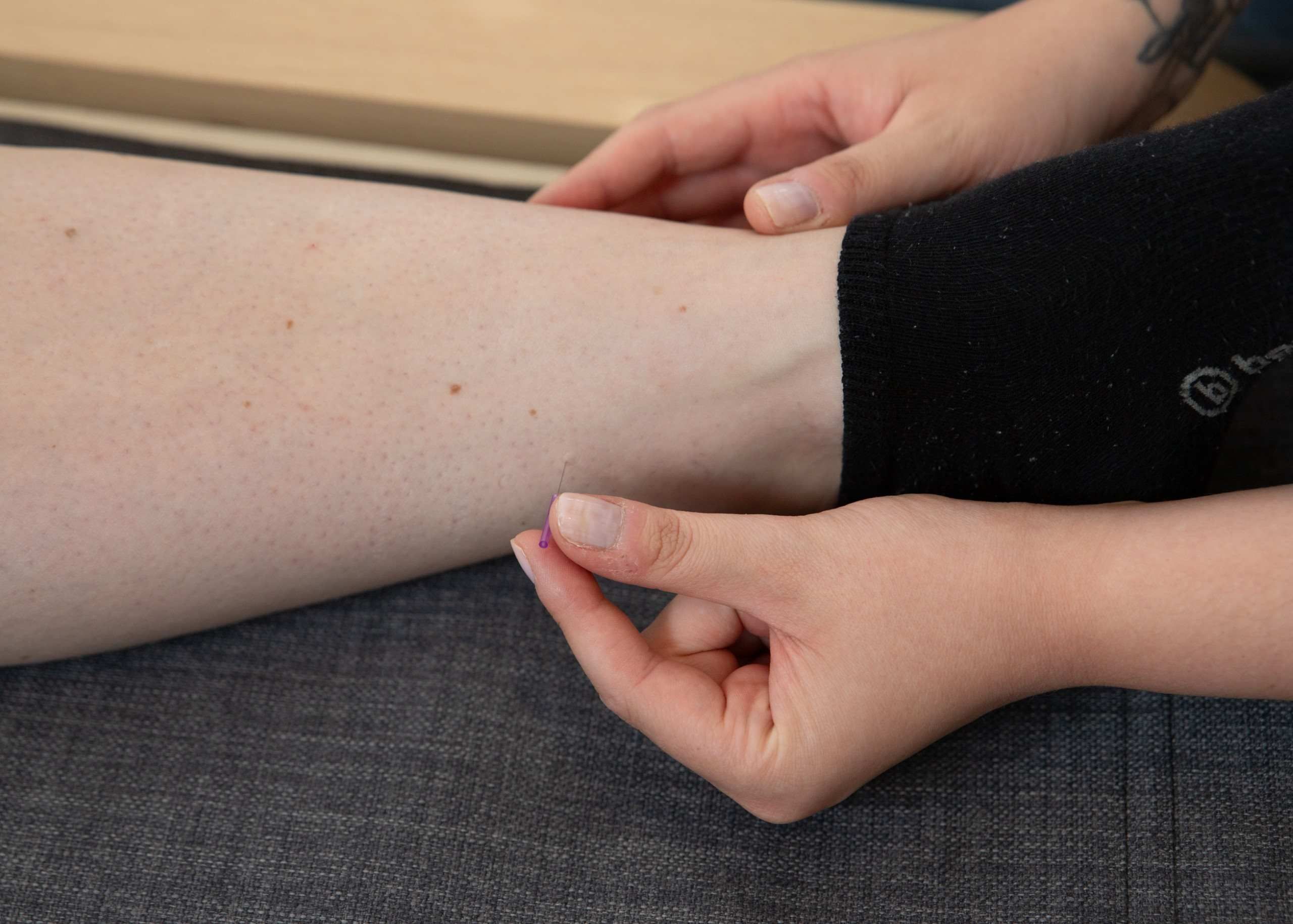 Acupunture